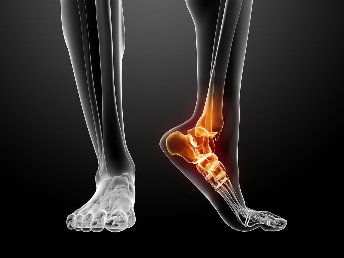 Biomechanics and gait assessment