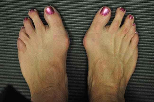 Forefoot pain assessment and treatment